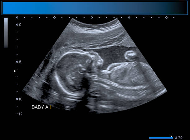 Ultrasound &amp; Pathology